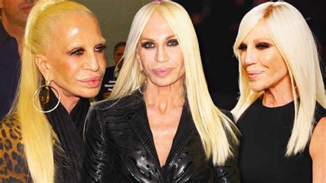 donatella versace a milano|donatella versace face what happened.